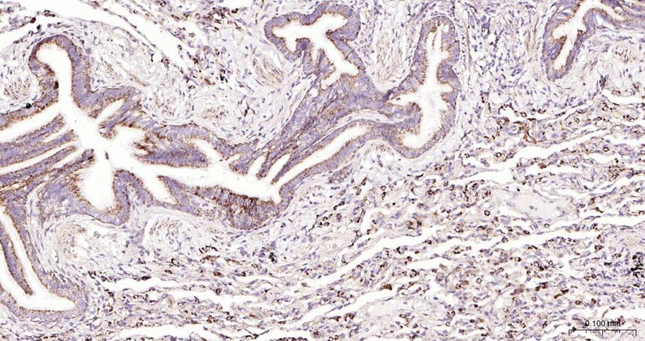骨形态发生蛋白4重组兔单抗