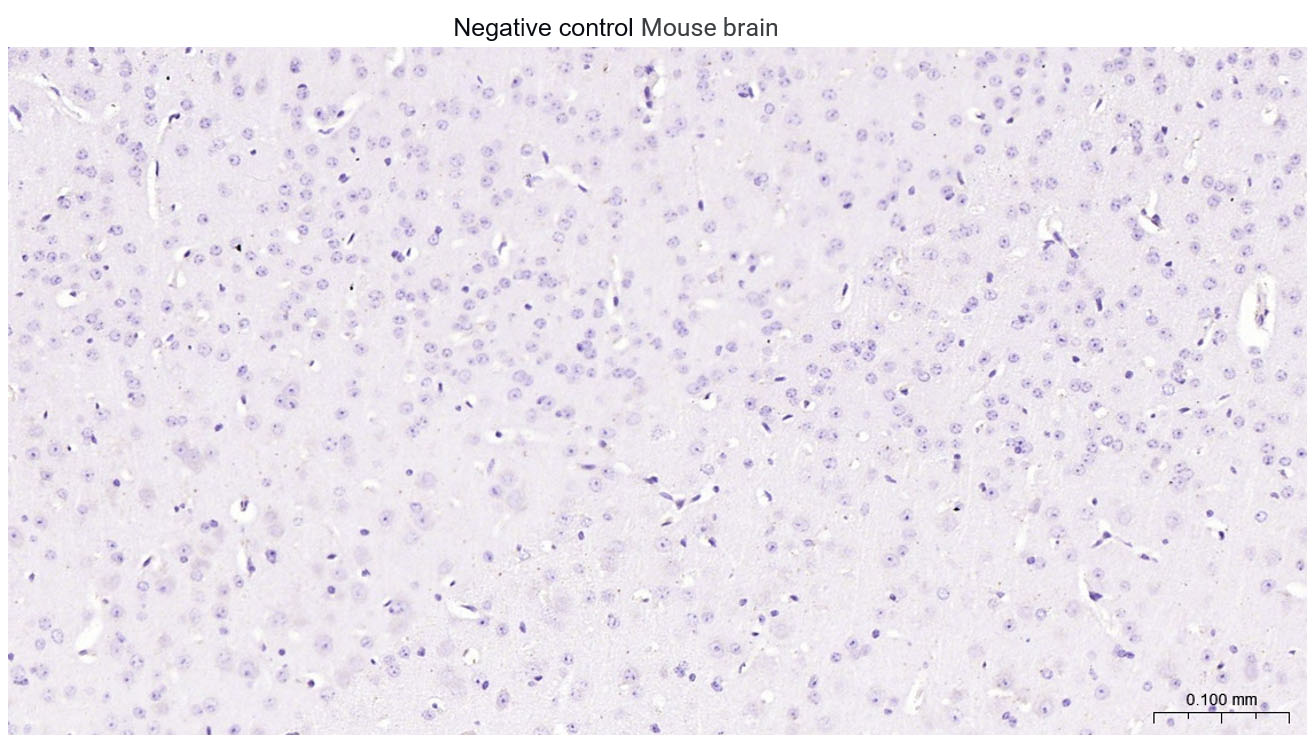 肾上腺皮质线粒体铁氧还蛋白重组兔单抗