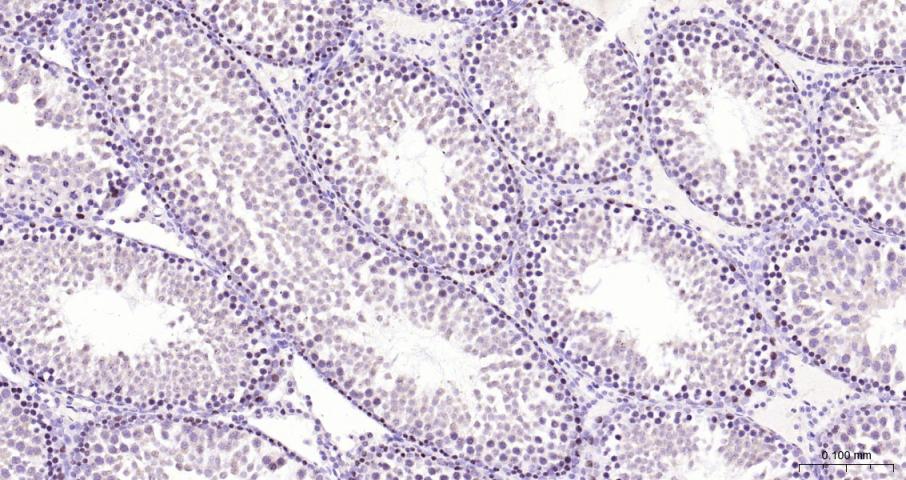 DNA甲基转移酶1重组兔单抗