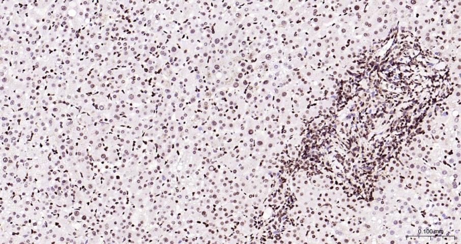 磷酸化双微体2癌基因重组兔单抗