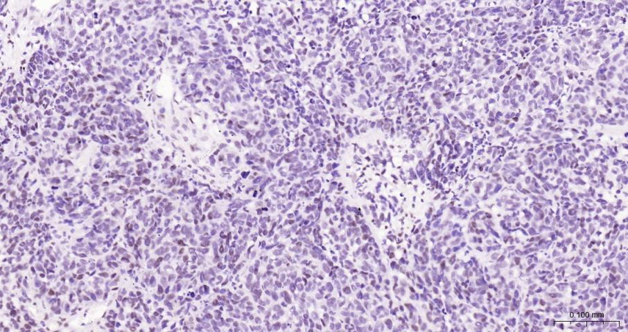 果糖-2,6-二磷酸酶3/磷酸果糖激酶2重组兔单抗-bsm-61693R