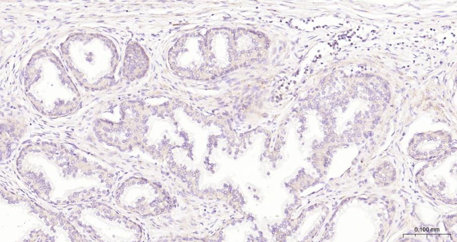 骨形态发生蛋白4重组兔单抗