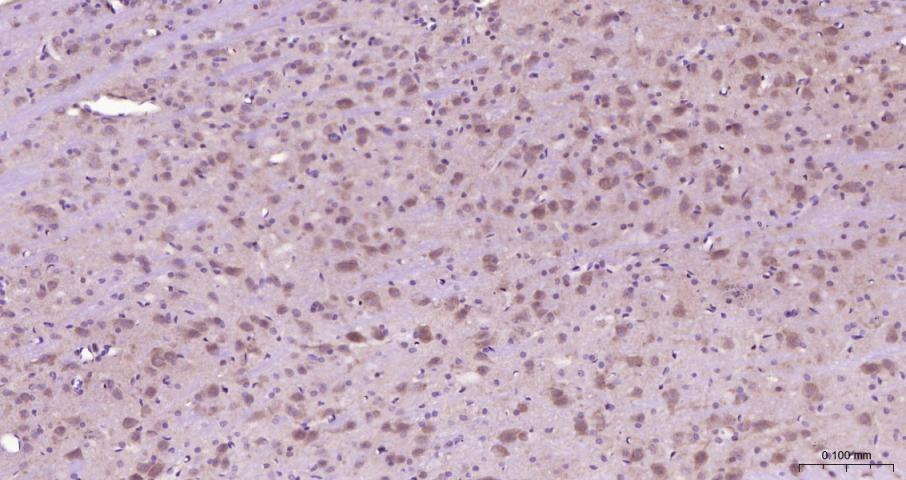 促凋亡调节蛋白BNIP3重组兔单抗