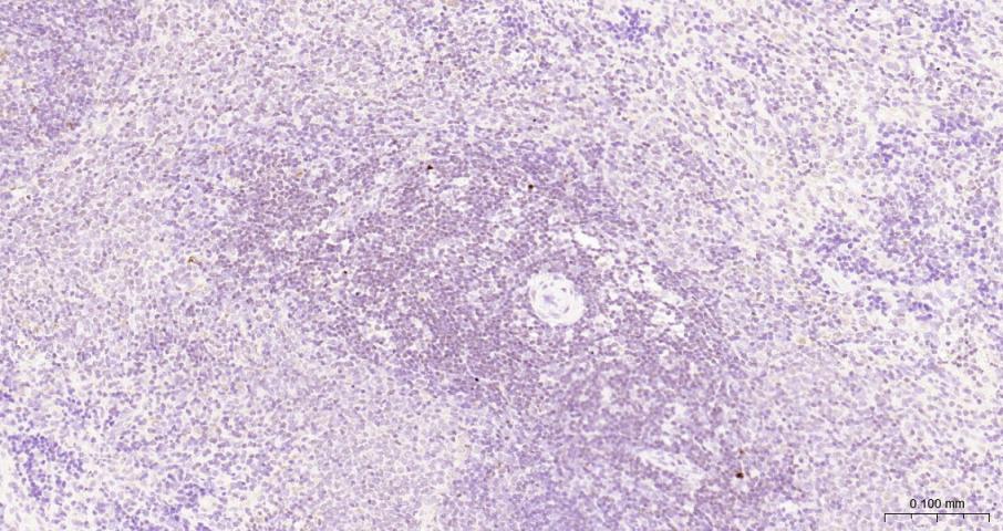果糖-2,6-二磷酸酶3/磷酸果糖激酶2重组兔单抗-bsm-61693R