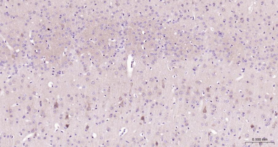 促凋亡调节蛋白BNIP3重组兔单抗