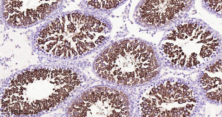 核因子2相关因子2重组兔单抗