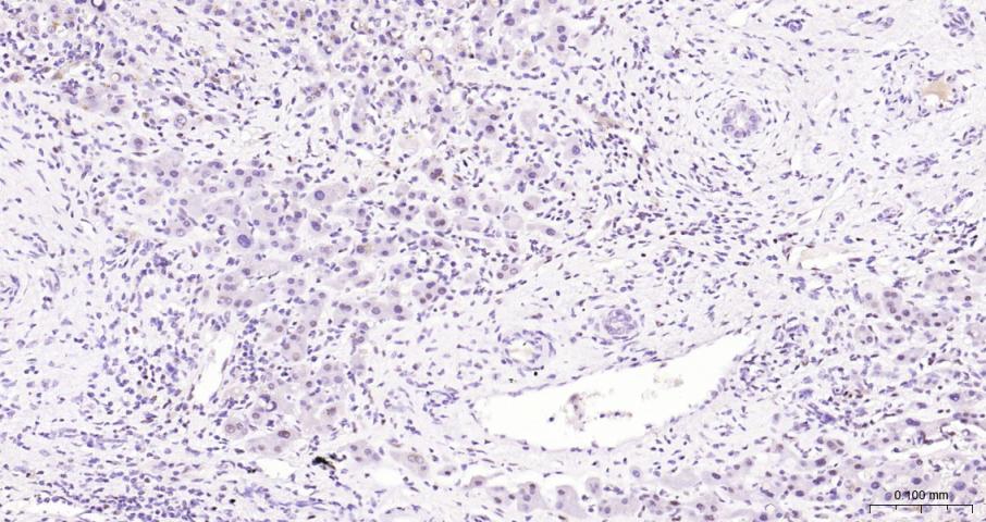 果糖-2,6-二磷酸酶3/磷酸果糖激酶2重组兔单抗-bsm-61693R