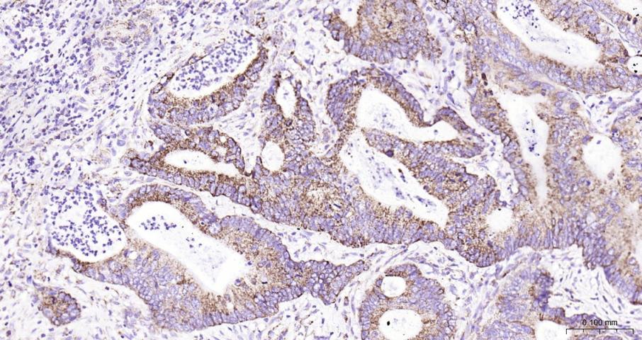 细胞色素c氧化酶IV亚型1(内参)重组兔单抗