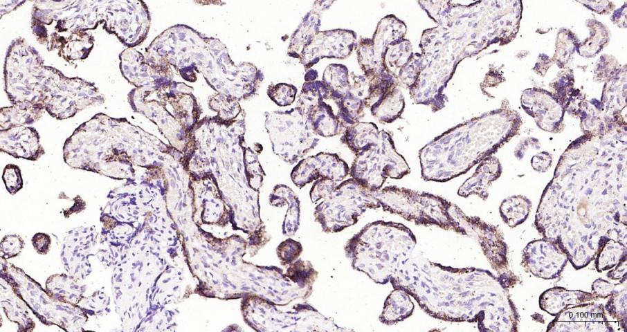 肾上腺皮质线粒体铁氧还蛋白重组兔单抗