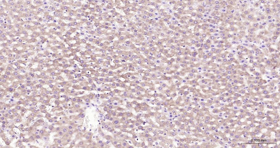 促凋亡调节蛋白BNIP3重组兔单抗