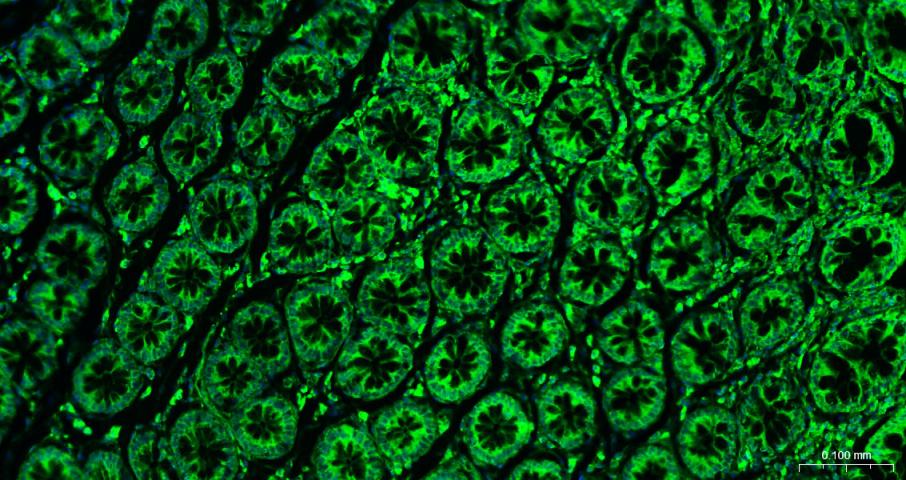 BF488标记的钙网蛋白抗体