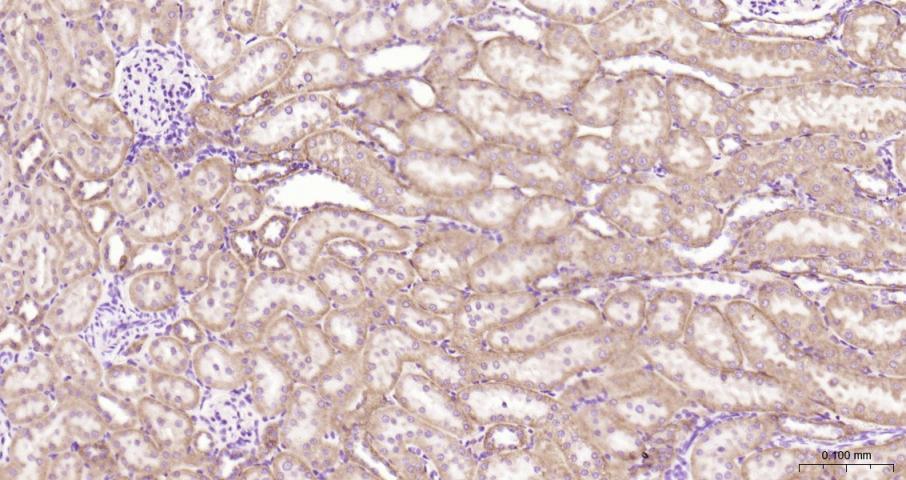 细胞色素c氧化酶IV亚型1(内参)重组兔单抗