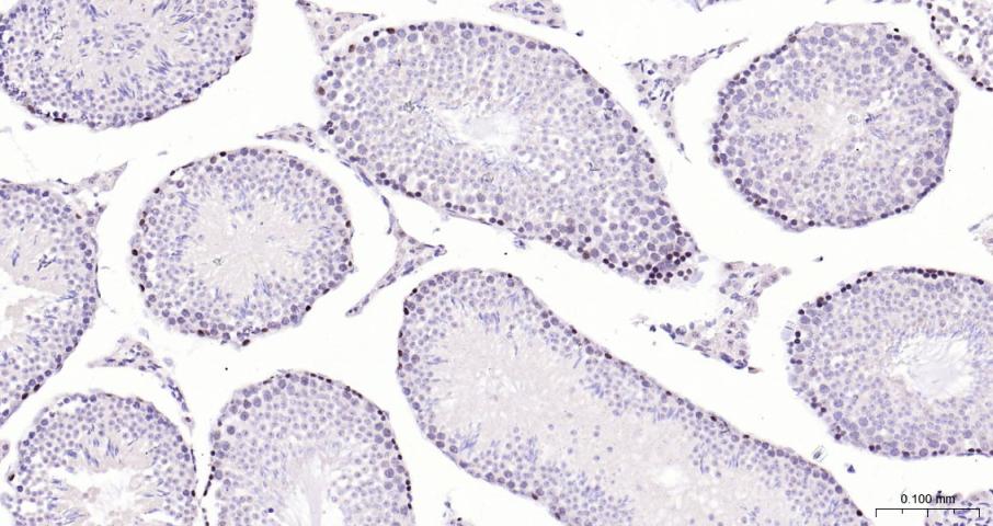 DNA甲基转移酶1重组兔单抗
