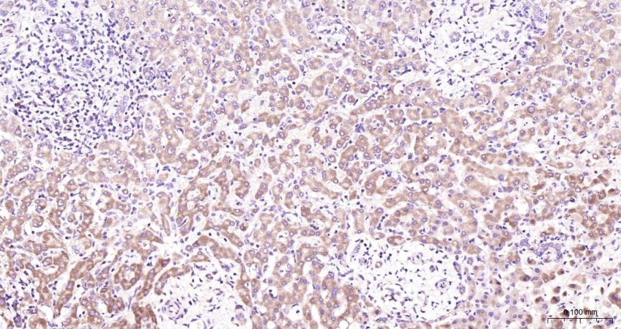 促凋亡调节蛋白BNIP3重组兔单抗
