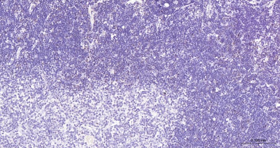 DNA甲基转移酶1重组兔单抗