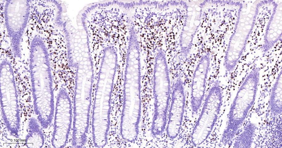 干扰素调节因子4重组兔单抗