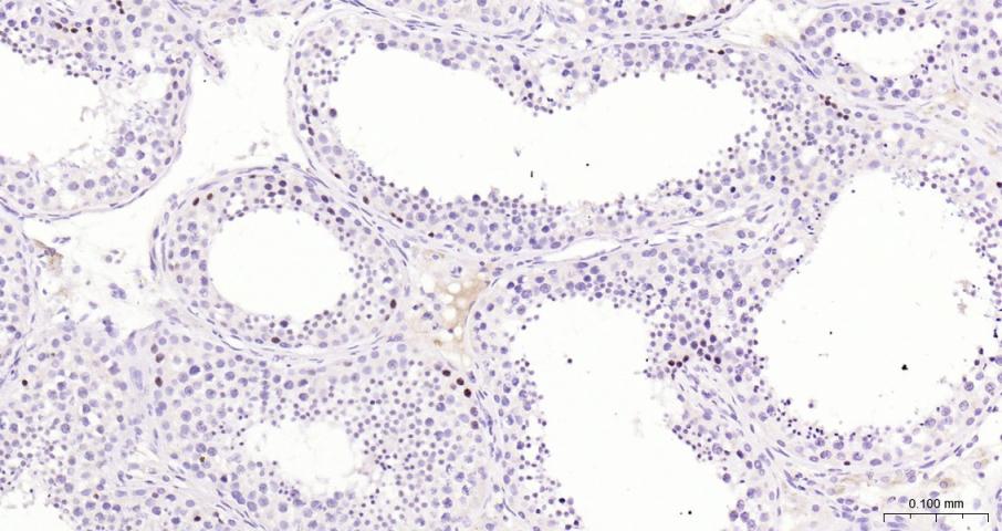 DNA甲基转移酶1重组兔单抗