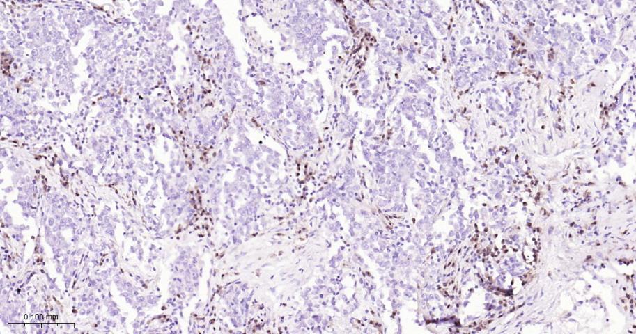 干扰素调节因子4重组兔单抗