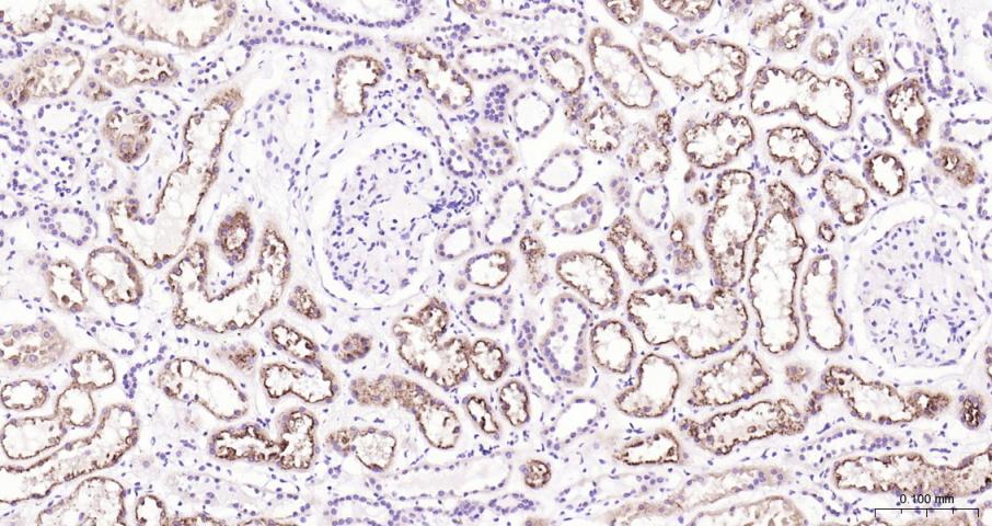 促凋亡调节蛋白BNIP3重组兔单抗