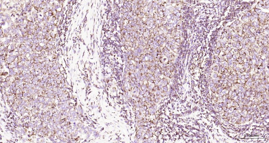 细胞色素c氧化酶IV亚型1(内参)重组兔单抗