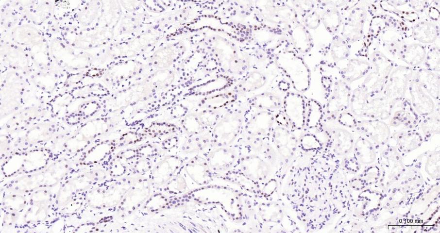 果糖-2,6-二磷酸酶3/磷酸果糖激酶2重组兔单抗-bsm-61693R