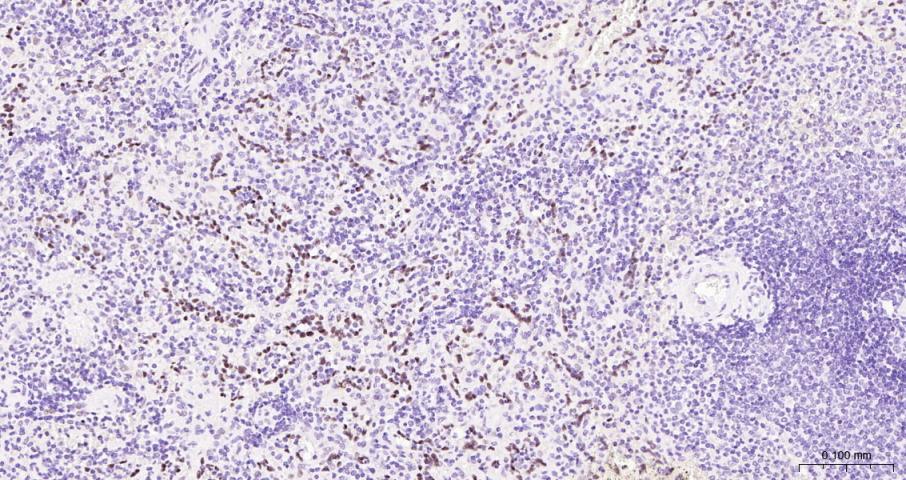 果糖-2,6-二磷酸酶3/磷酸果糖激酶2重组兔单抗-bsm-61693R