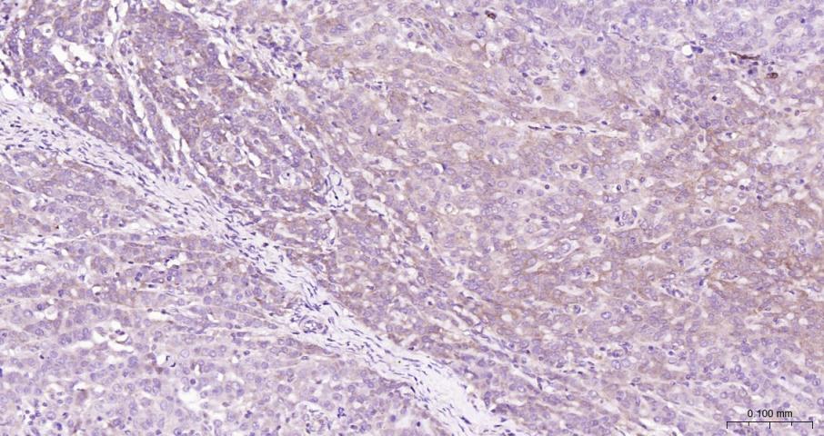 促凋亡调节蛋白BNIP3重组兔单抗
