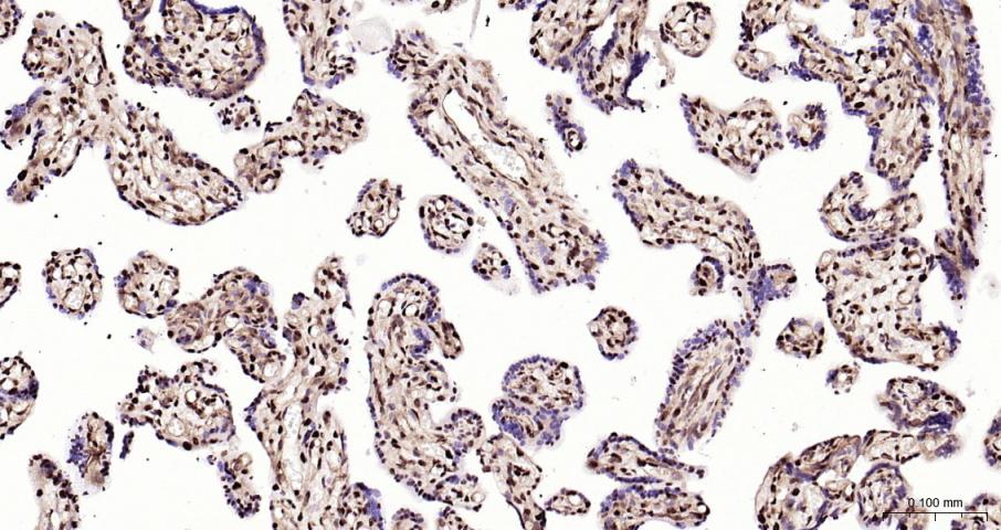磷酸化双微体2癌基因重组兔单抗
