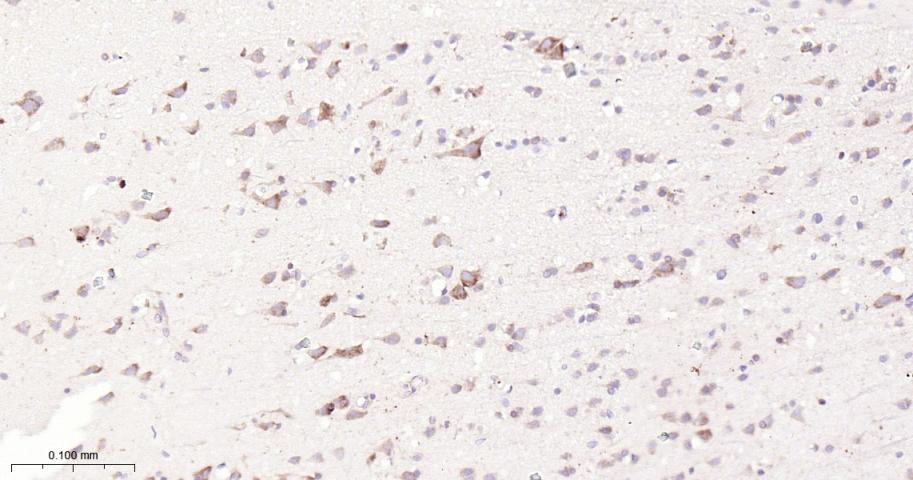 核因子2相关因子2重组兔单抗