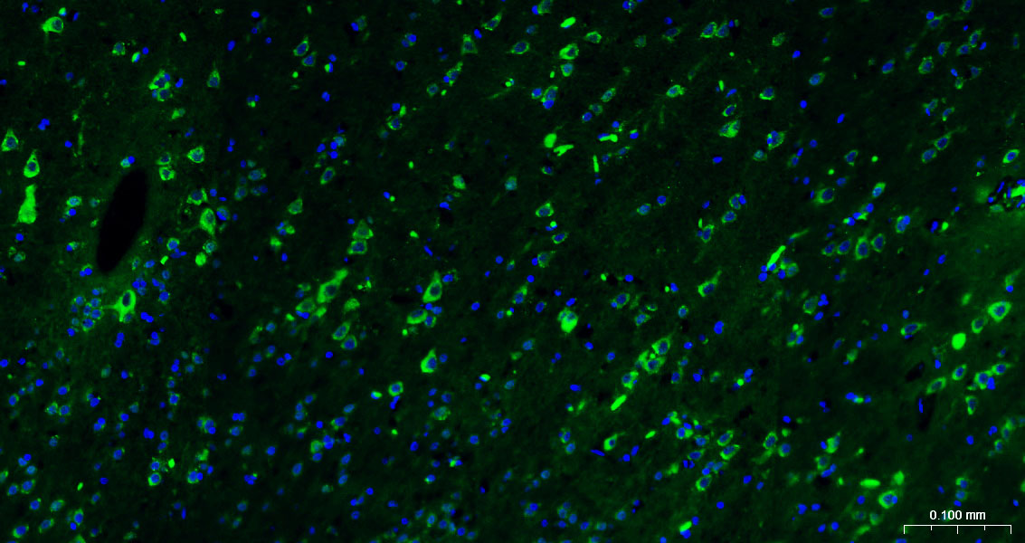 BF488标记的钙网蛋白抗体