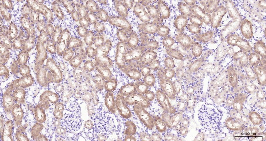促凋亡调节蛋白BNIP3重组兔单抗