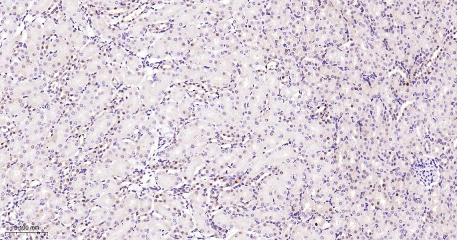 周期素依赖性激酶4重组兔单抗