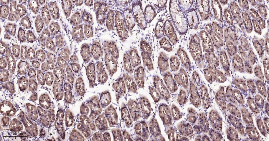 异柠檬酸脱氢酶1重组兔单抗