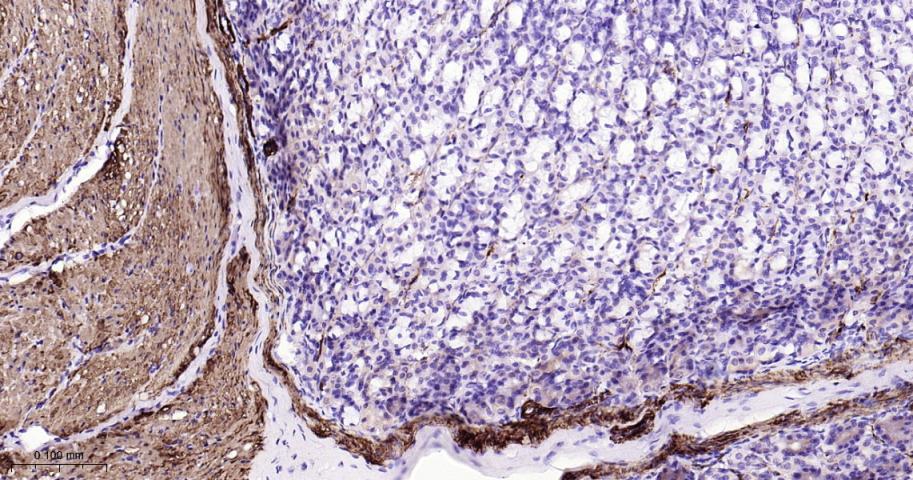 平滑肌肌球蛋白重链抗体