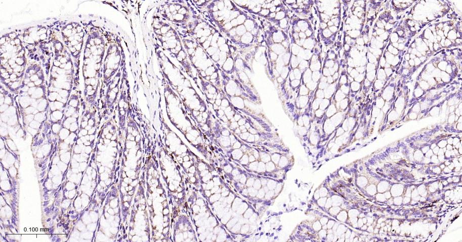 蛋白质酪氨酸激酶JAK-1重组兔单抗