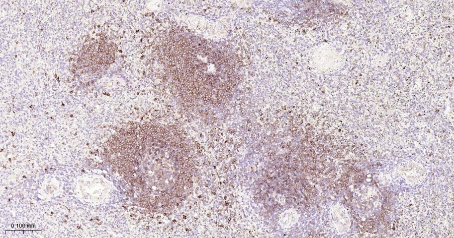 B淋巴细胞粘附分子CD22重组兔单抗