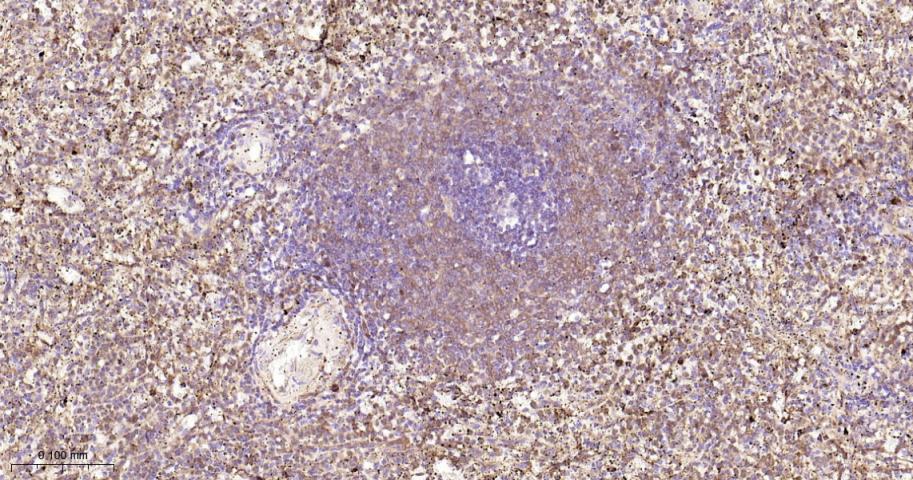 信号转导与转录激活因子1重组兔单抗