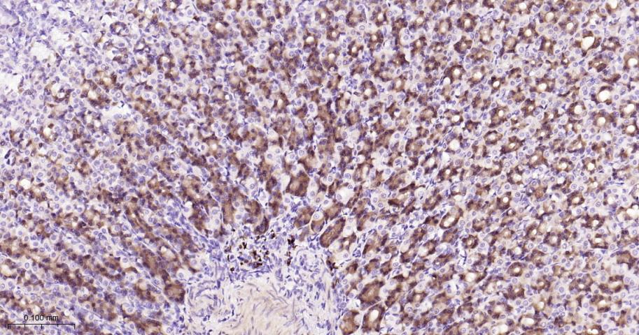 葡萄糖调节蛋白94重组兔单抗