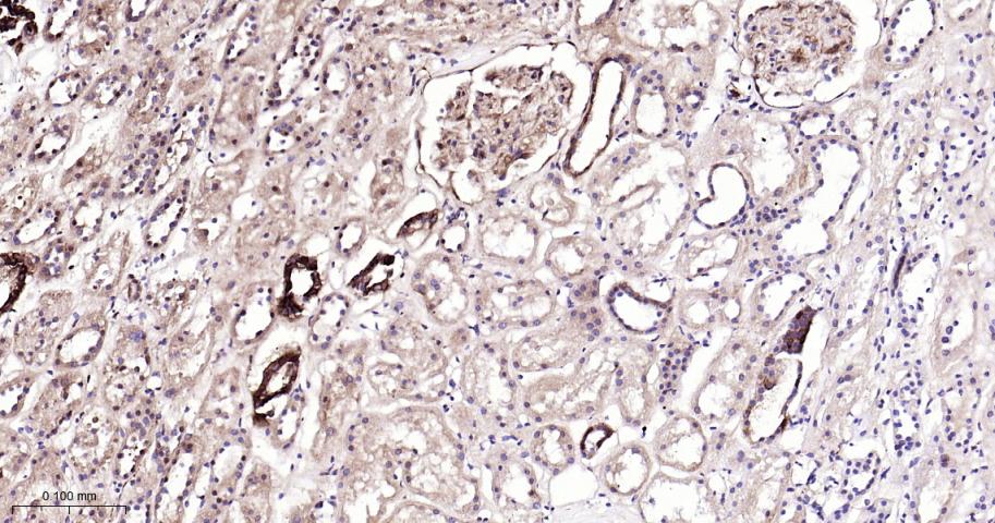 信号转导与转录激活因子1重组兔单抗