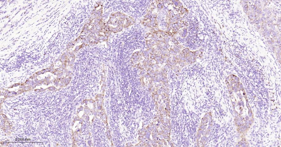 蛋白质酪氨酸激酶JAK-1重组兔单抗