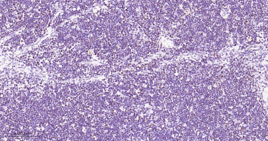 DNA甲基转移酶1重组兔单抗