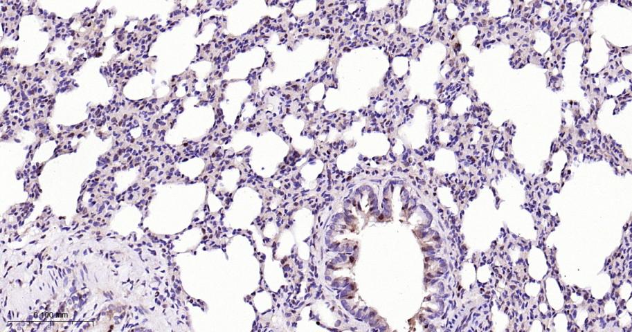 周期素依赖性激酶4重组兔单抗