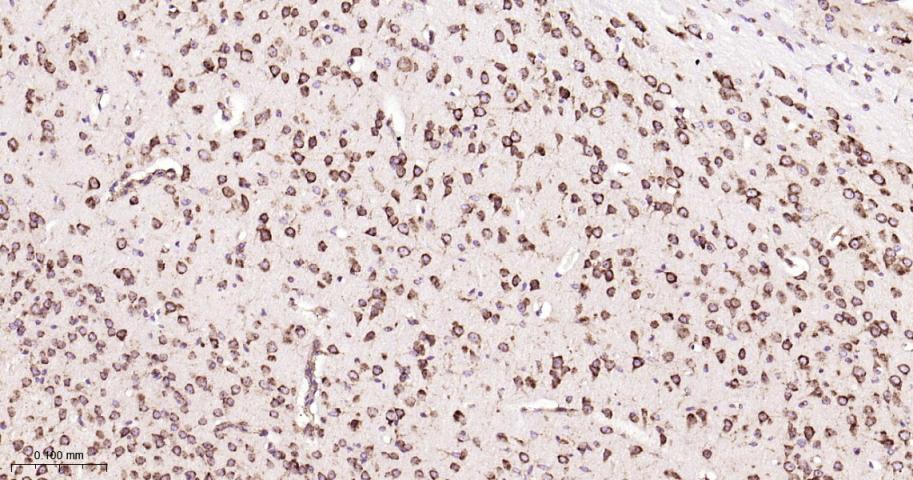 葡萄糖调节蛋白94重组兔单抗