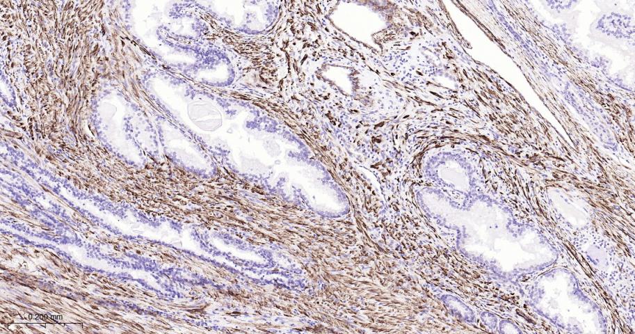 平滑肌肌球蛋白重链抗体