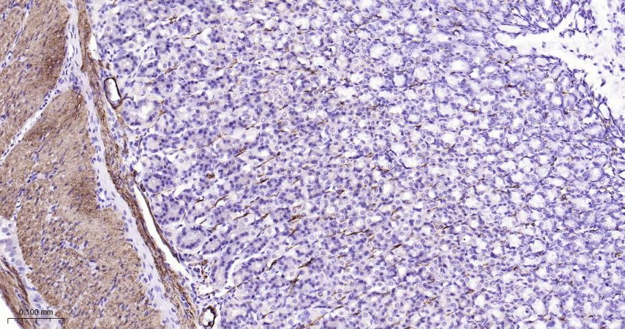 平滑肌肌球蛋白重链抗体