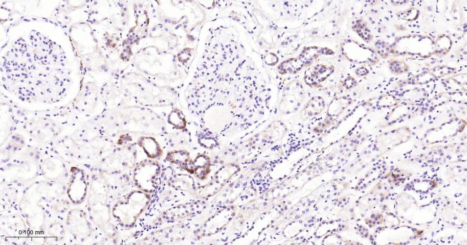 蛋白质酪氨酸激酶JAK-1重组兔单抗
