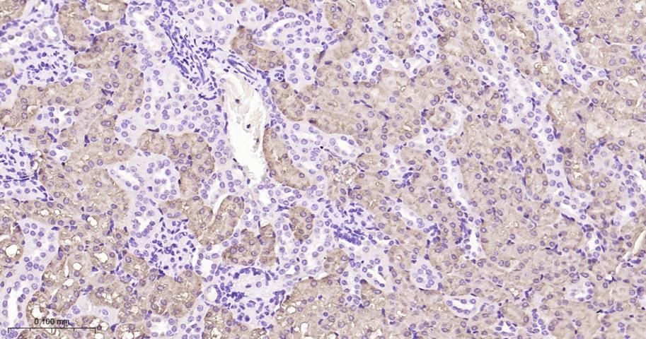异柠檬酸脱氢酶1重组兔单抗
