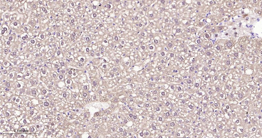 异柠檬酸脱氢酶1重组兔单抗