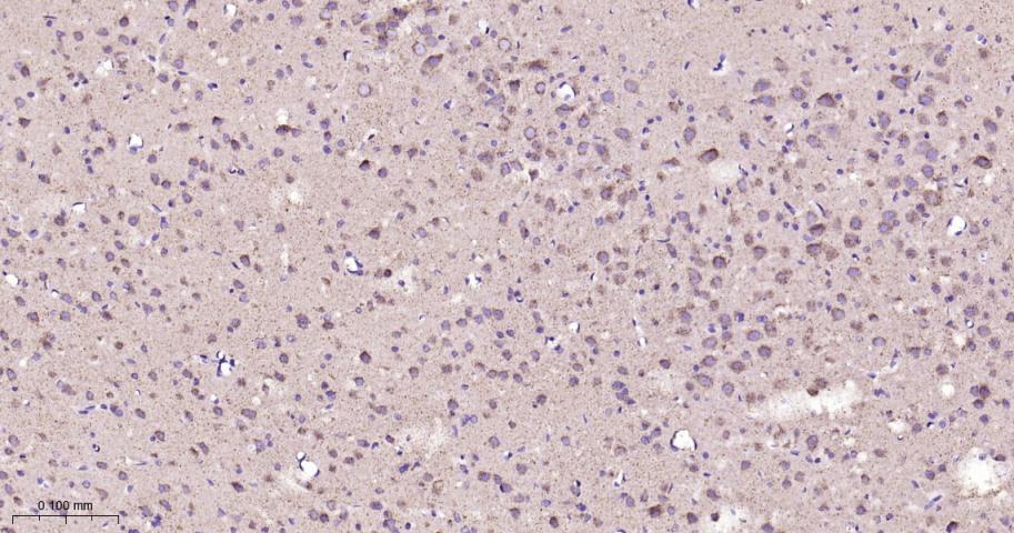热休克蛋白10/HSPE1重组兔单抗