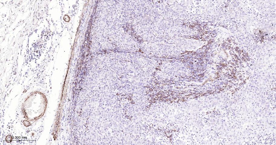 平滑肌肌球蛋白重链抗体